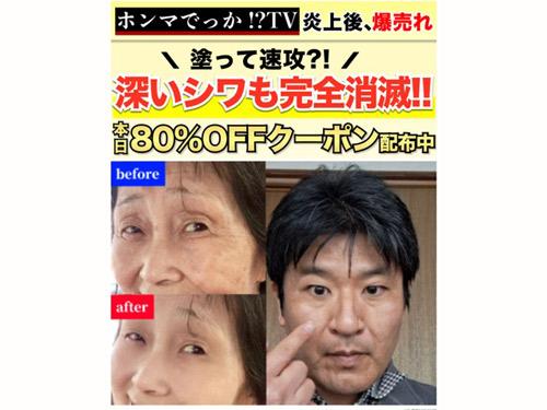 違反認定されたビフォーアフターの写真